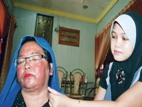 Hasad Dengki : Peniaga Emas Disimbah Asid